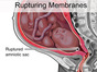 Rupturing_Membranes